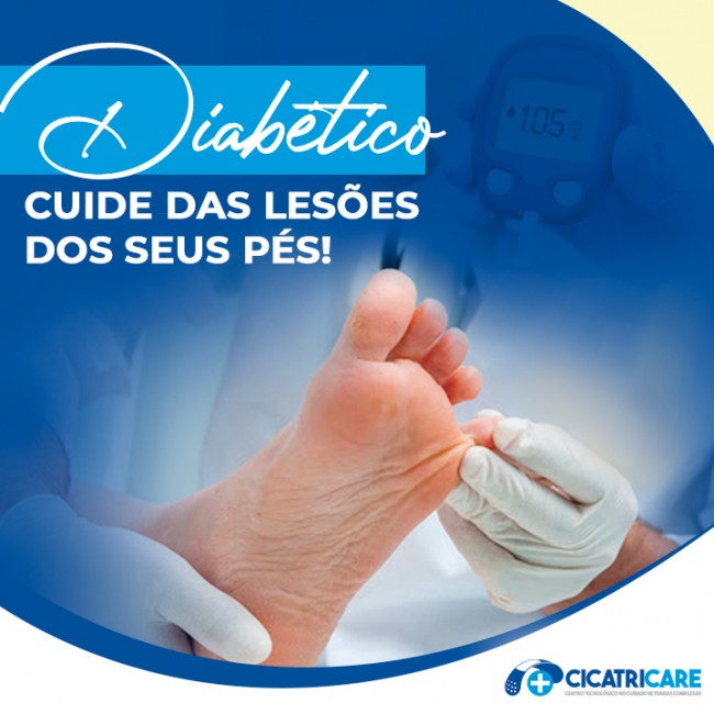 Diabético cuide das lesões dos seus pés!