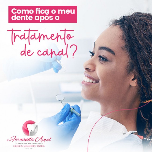 Como fica o meu dente após o tratamento de canal?