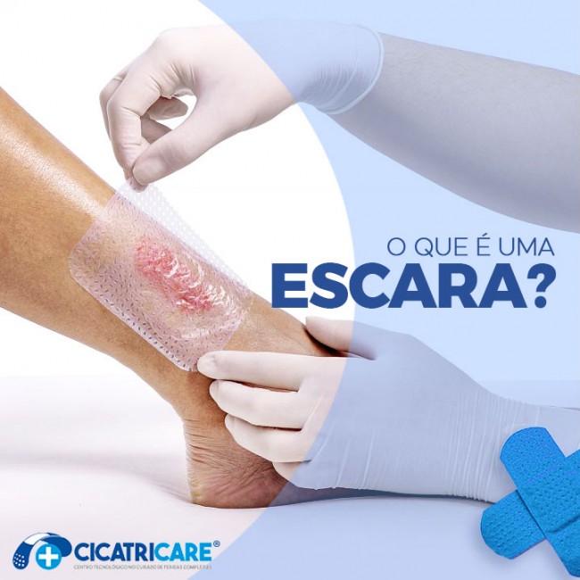 O que é uma escara?