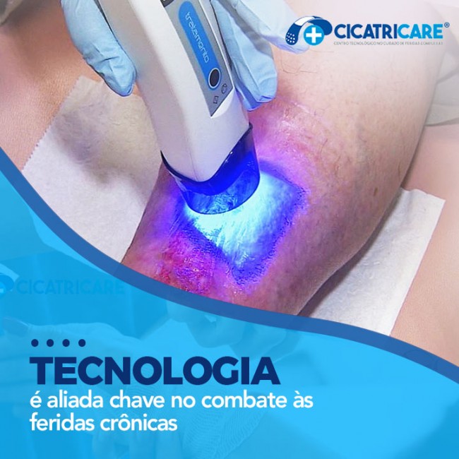 Tecnologia é aliada chave no combate às feridas crônicas