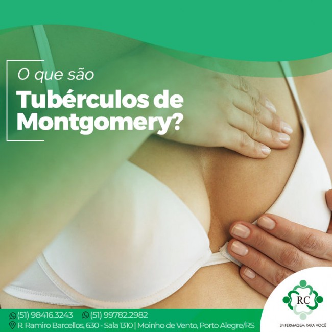 O que são tubérculos de Montgomery?