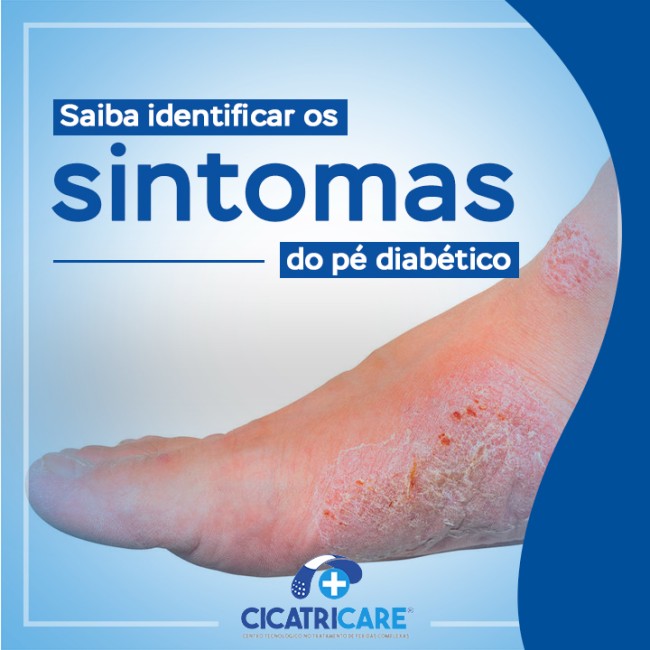 Saiba identificar os sintomas do pé diabético