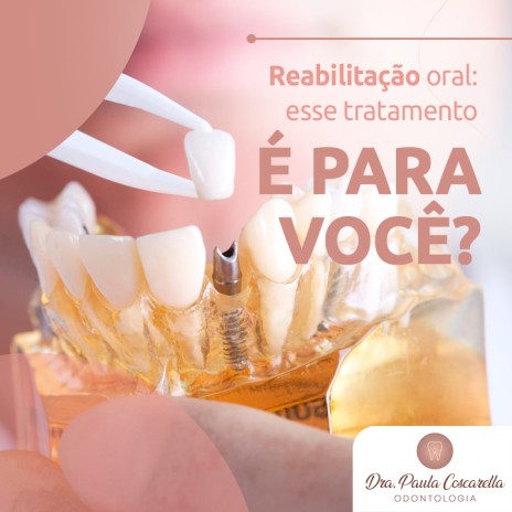 Reabilitação oral: esse tratamento é para você?