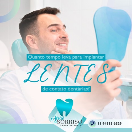 Quanto tempo leva para implantar lentes de contato dentárias?