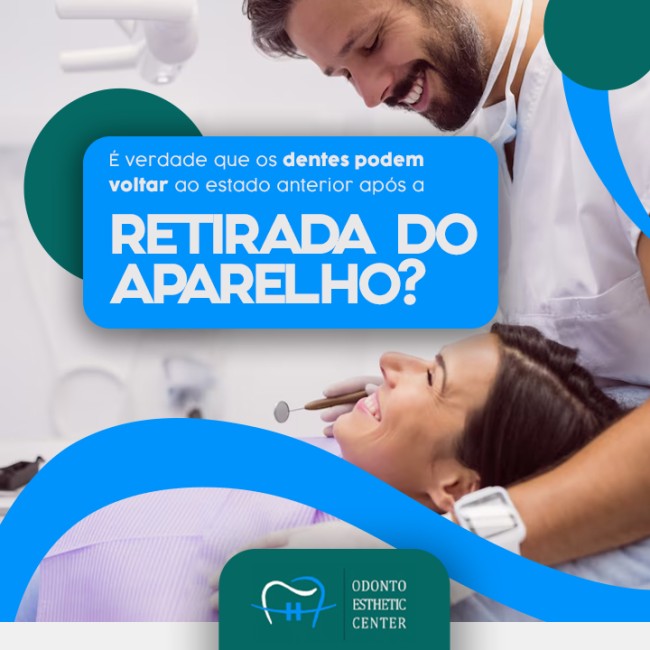 É verdade que os dentes podem voltar ao estado anterior após a retirada do aparelho