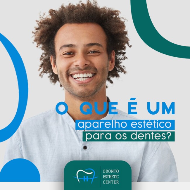 O que é um aparelho estético para os dentes?