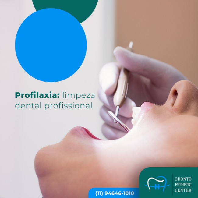 Profilaxia: limpeza dental profissional