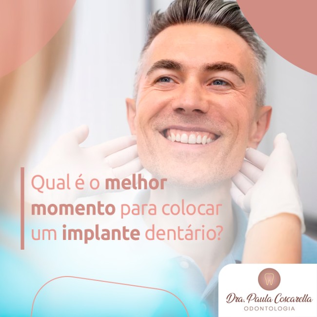 Qual é o melhor momento para colocar um implante dentário?