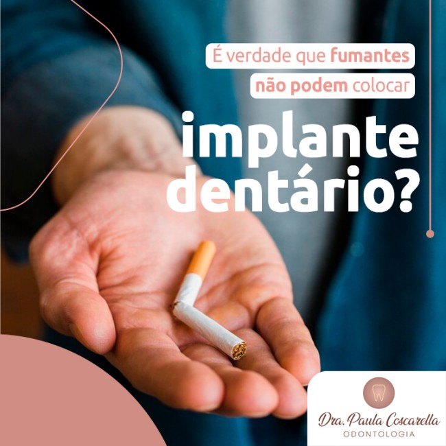 É verdade que fumantes não podem colocar implante dentário?