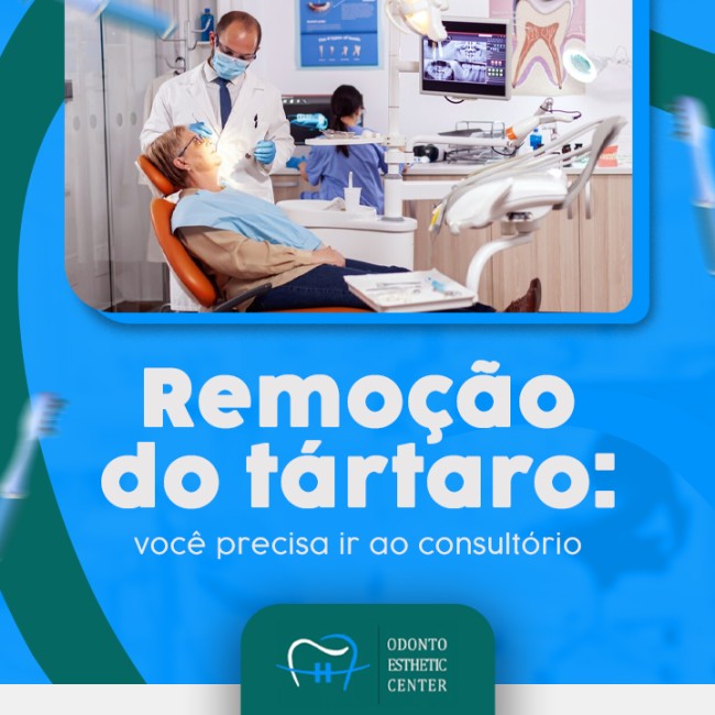Remoção do tártaro: você precisa ir ao consultório