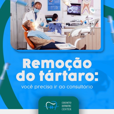 Remoção do tártaro: você precisa ir ao consultório