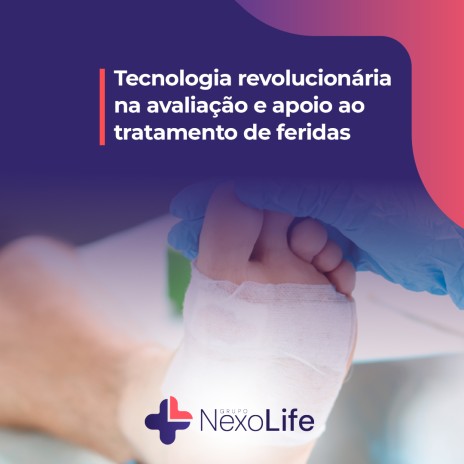 Tecnologia revolucionária na avaliação e apoio ao tratamento de feridas