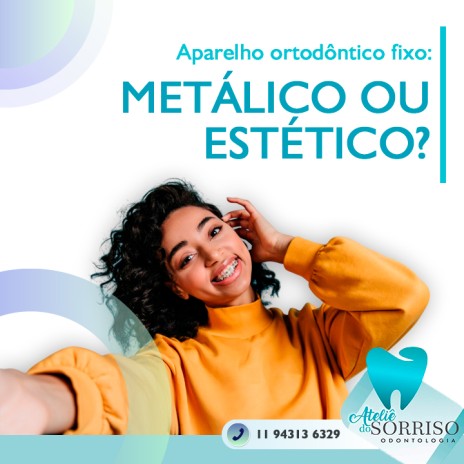 Aparelho ortodôntico fixo: metálico ou estético?