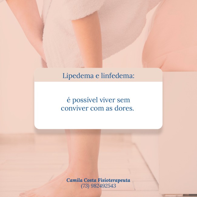 Lipedema e linfedema: é possível viver sem conviver com as dores
