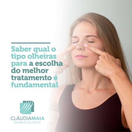 Causa das olheiras e importância das mudanças comportamentais