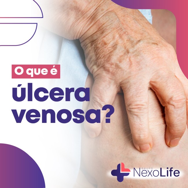 O que é úlcera venosa?