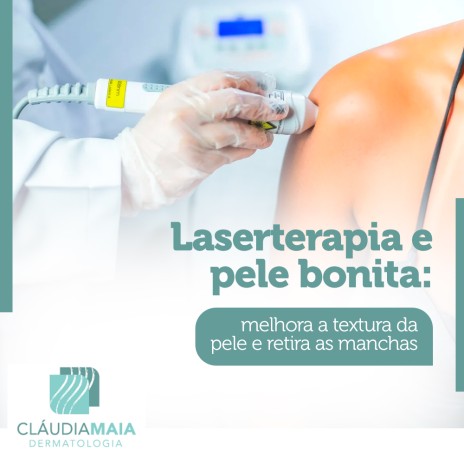 Laserterapia e pele bonita: melhora a textura da pele e retira as manchas