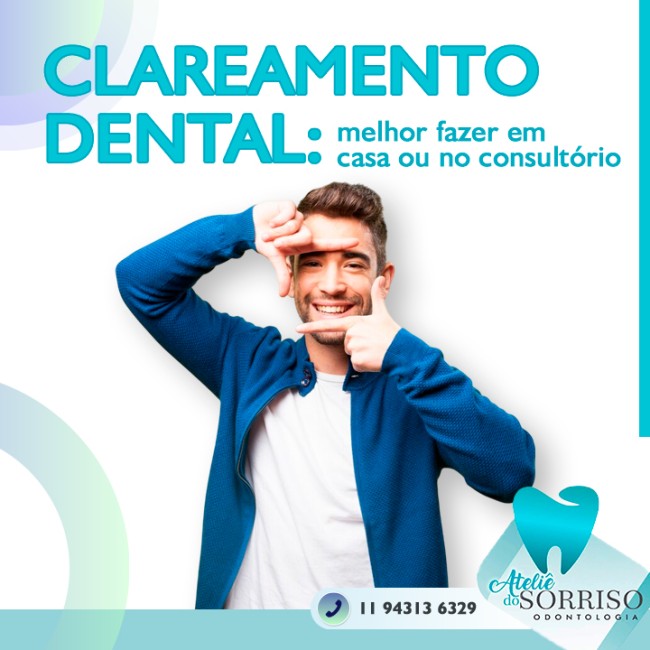 Clareamento dental: melhor fazer em casa ou no consultório