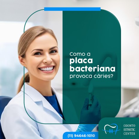 Como a placa bacteriana provoca cáries?