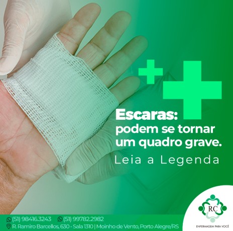 Escaras: podem se tornar um quadro grave