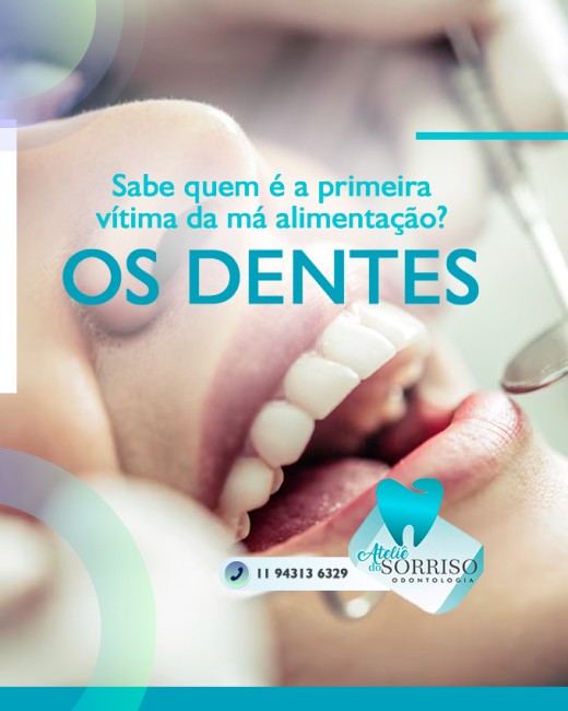Sabe quem é a primeira vítima da má alimentação? Os dentes