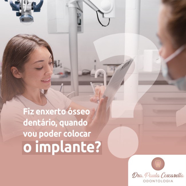 Fiz enxerto ósseo dentário, quando vou poder colocar o implante?