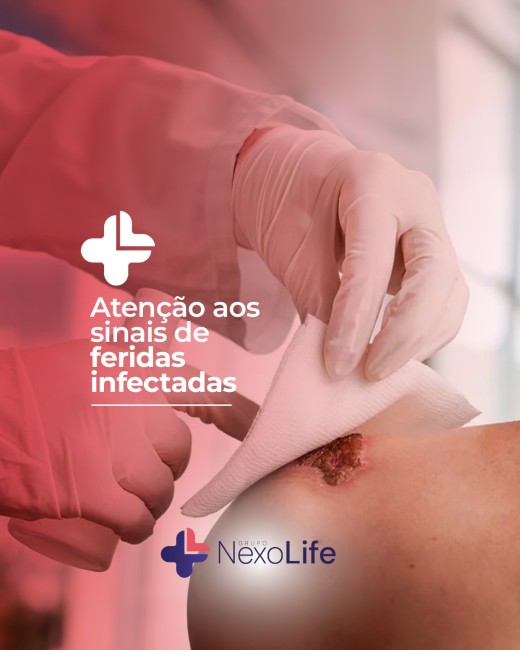 Atenção aos sinais de feridas infectadas?