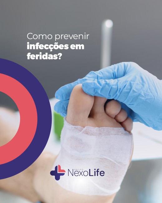 Como prevenir infecções em feridas?