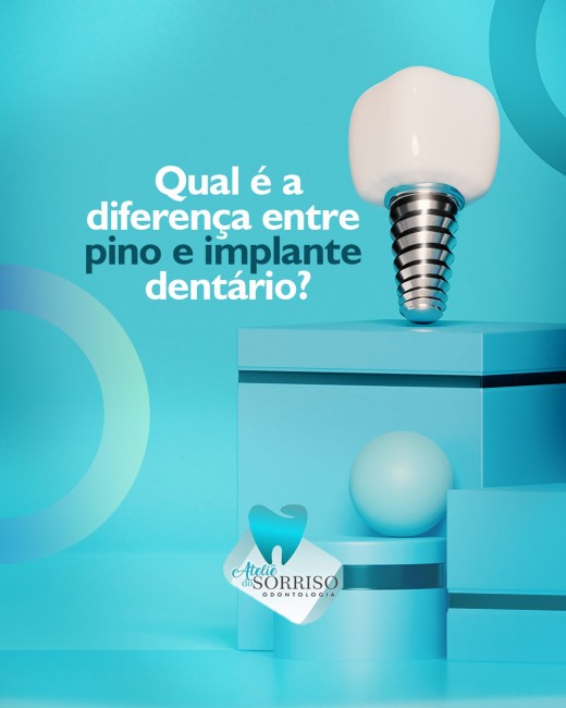 Qual é a diferença entre pino e implante dentário?