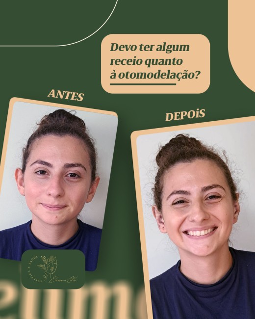 Devo ter algum receio quanto à otomodelação?