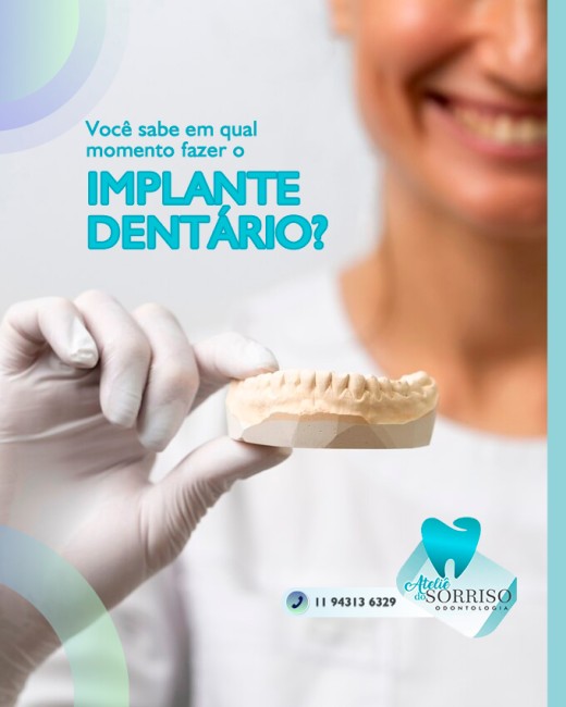 Você sabe em qual momento fazer o implante dentário?