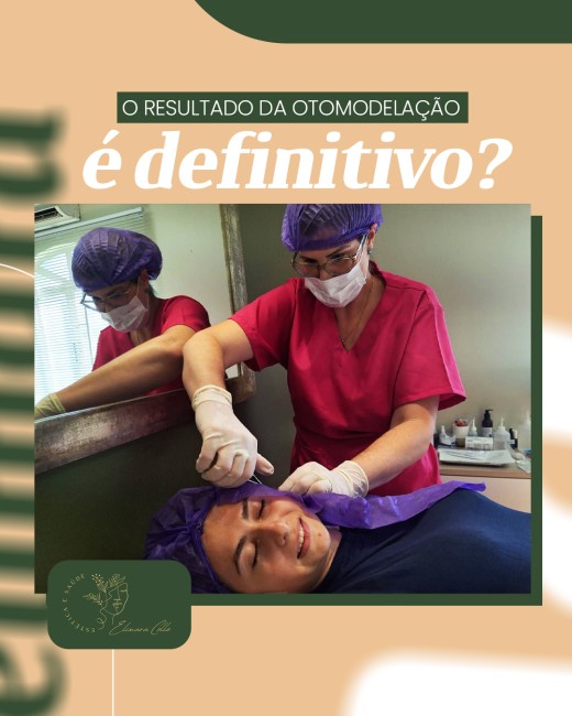 O resultado da otomodelação é definitivo?