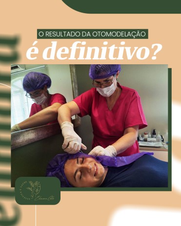 O resultado da otomodelação é definitivo?