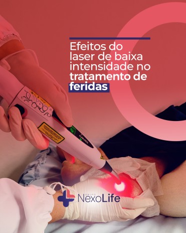 Efeitos do laser de baixa intensidade no tratamento de feridas
