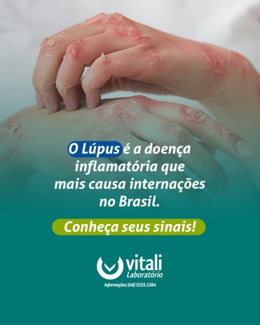 O Lúpus é a doença inflamatória que mais causa internações no Brasil. Conheça seus sinais!