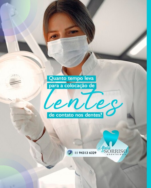 Quanto tempo leva para a colocação de lentes de contato nos dentes?