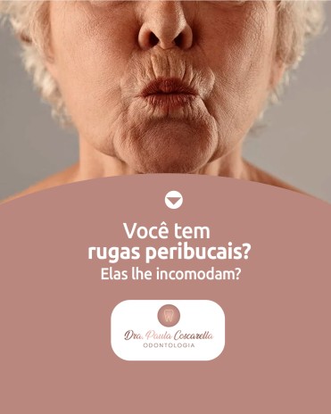 Você tem rugas peribucais? Elas lhe incomodam?