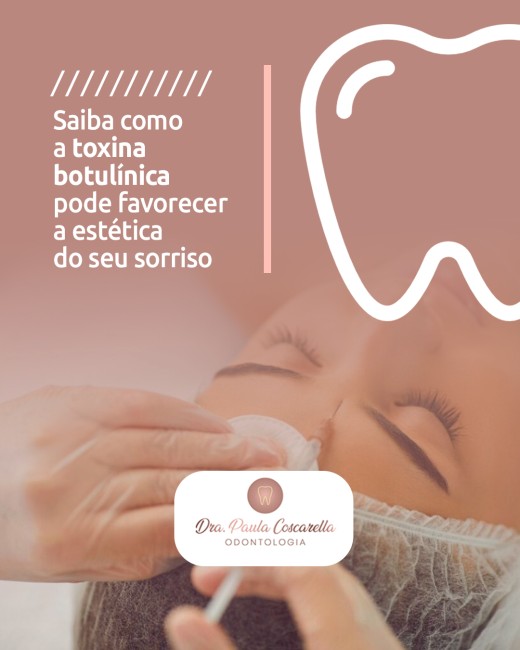 Saiba como a toxina botulínica pode favorecer a estética do seu sorriso