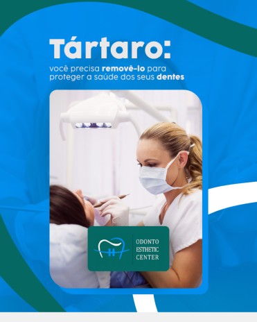 Tártaro: você precisa removê-lo para proteger a saúde dos seus dentes