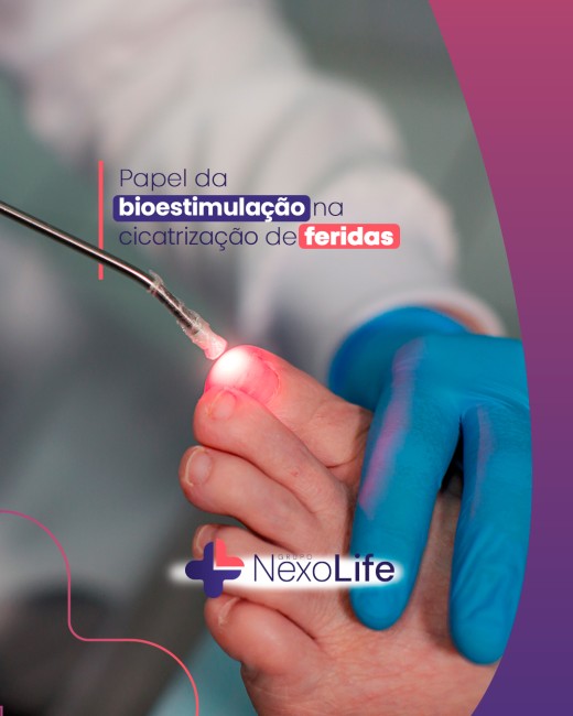 Papel da bioestimulação na cicatrização de feridas