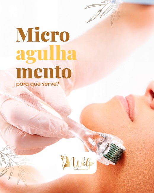 Microagulhamento: para que serve?