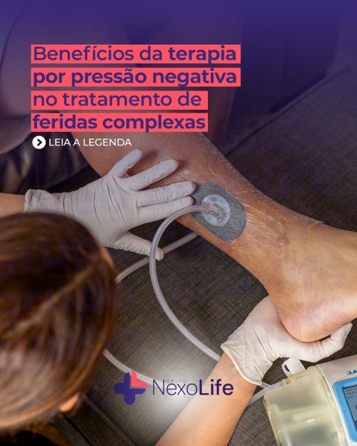 Benefícios da terapia por pressão negativa no tratamento de feridas complexas