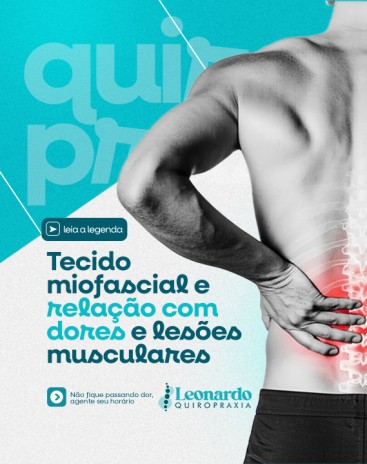 Tecido miofascial e relação com dores e lesões musculares
