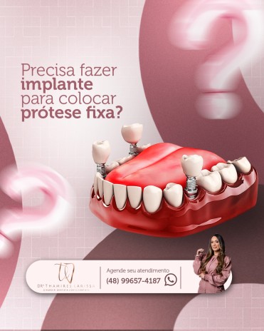 Precisa fazer implante para colocar prótese fixa?