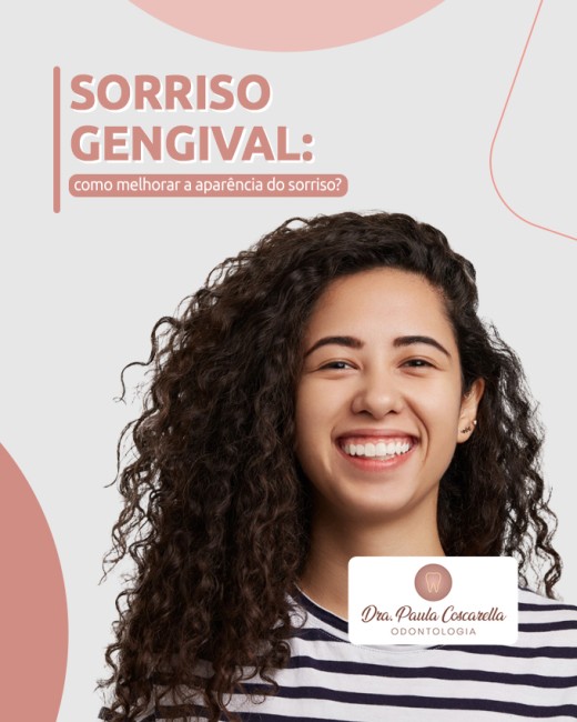 Sorriso gengival: como melhorar a aparência do sorriso?