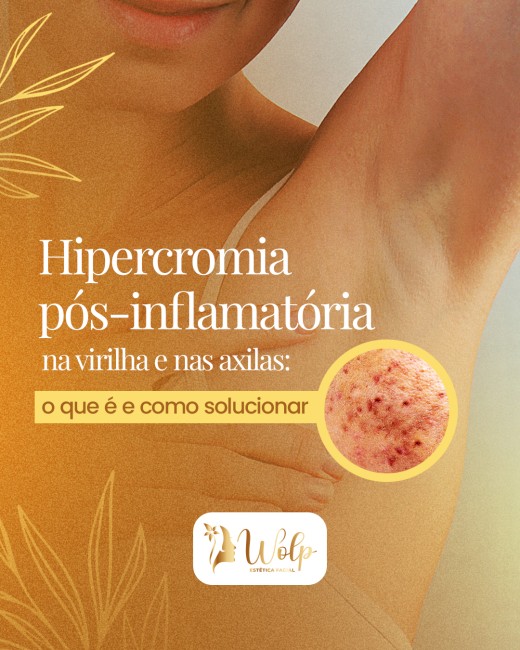 Hipercromia pós-inflamatória na virilha e nas axilas: o que é e como solucionar