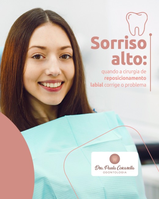 Sorriso alto: quando a cirurgia de reposicionamento labial corrige o problema