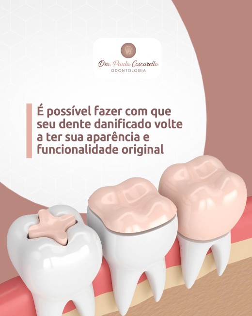 É possível fazer com que seu dente danificado volte a ter sua aparência e funcionalidade original
