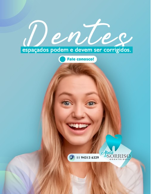 Dentes espaçados podem e devem ser corrigidos. Saiba por que