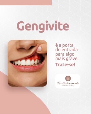 Gengivite é a porta de entrada para algo mais grave. Trate-se!